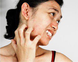 Skin Diseases
