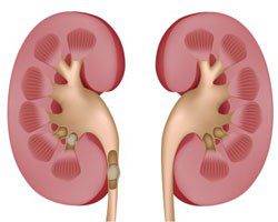 Urinary