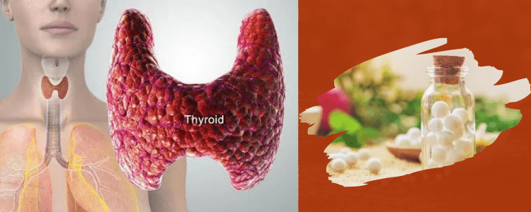 ISHOMEOPATHICTREATMENTEFFECTIVEFORTHYROID