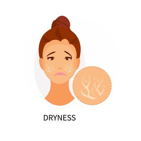 Dryness of skin