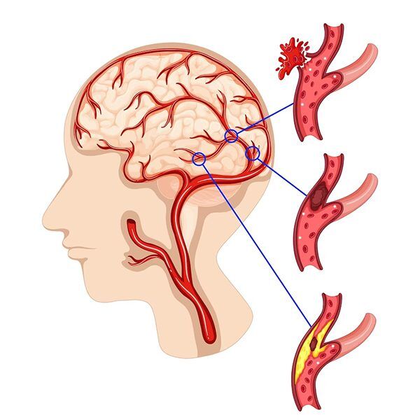 Cerebral circulation