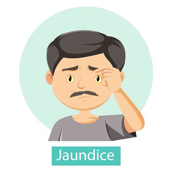 Jaundice