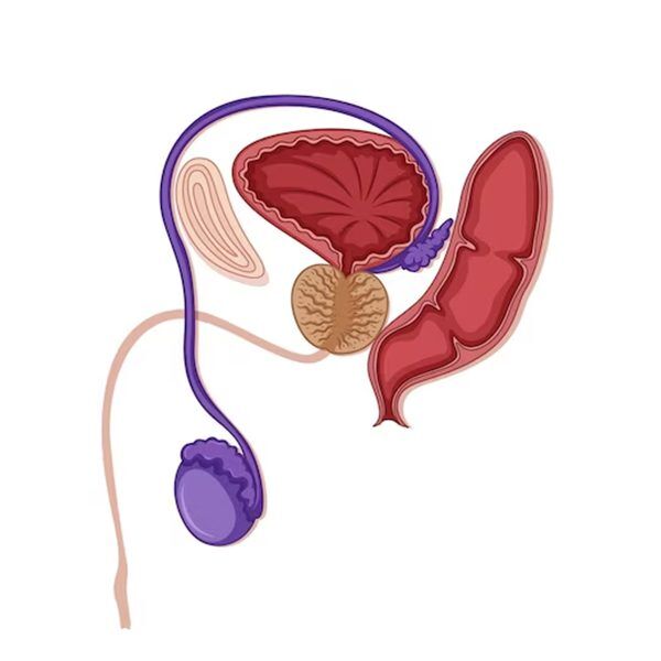 Prostate enlargement